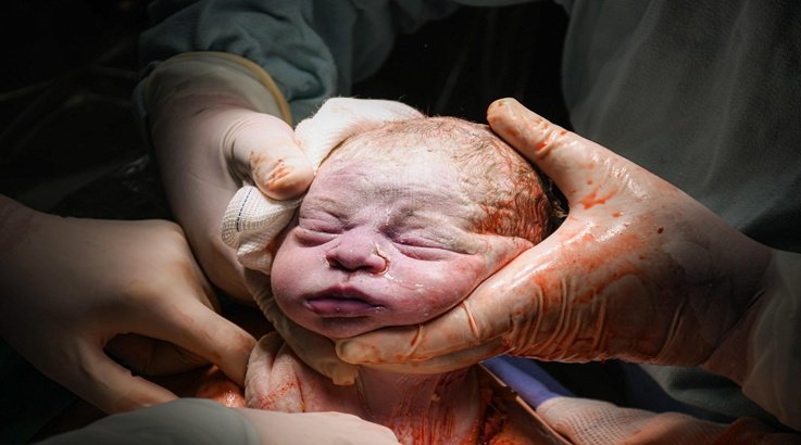 bebê